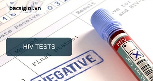 Kết quả xét nghiệm HIV âm tính là sao