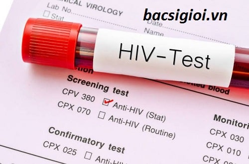 Xét nghiệm HIV là gì